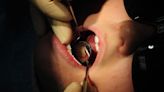 'I routinely take out 20 teeth for two-year-old children': Dentists warn of decay from sugary drinks