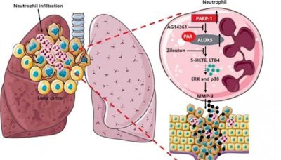 Breaking bad blood: how rogue neutrophils help lung cancer spread | Newswise: News for Journalists