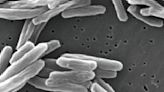 Brote de tuberculosis en un hotel para desamparados en Long Beach California provoca emergencia sanitaria