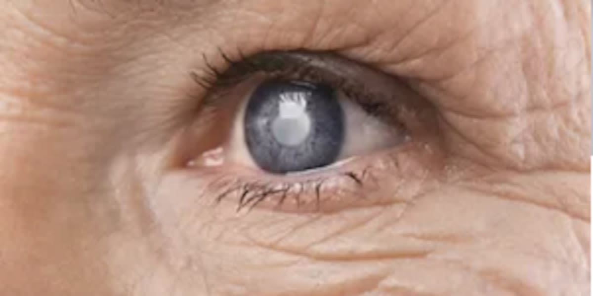When do you know it’s time to have cataract surgery?