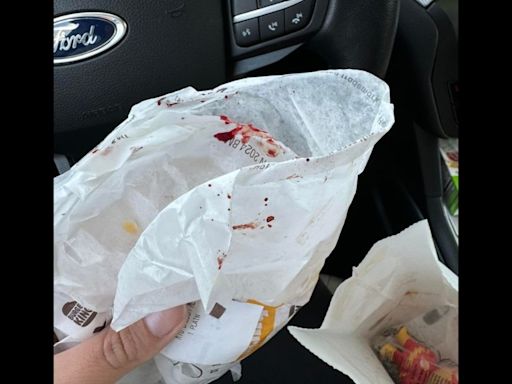 Furious NY mom claims Burger King meal for daughter, 4, had ‘blood all over’ it, company responds