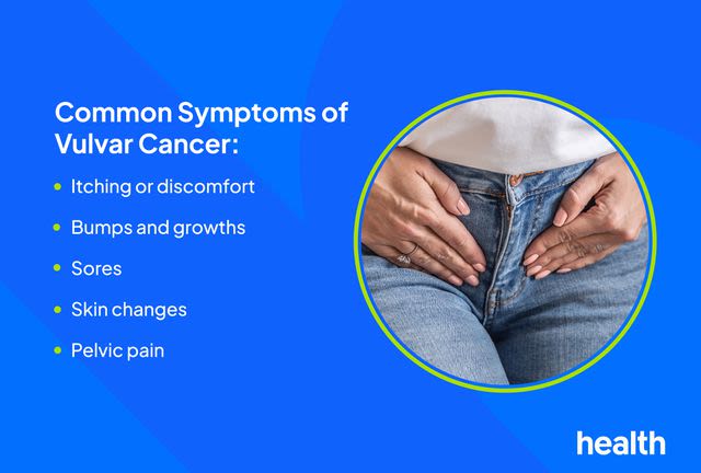 Signs and Symptoms of Vulvar Cancer