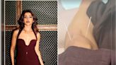 5 Beauty Benefits Of Acupuncture Which Will Make You Choose It Like Samantha Ruth Prabhu Did