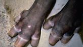 Horses ‘used to have toes’, new study shows