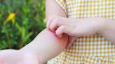 Symptoms of arthritis in children: Watch out for fever, rashes, swelling, joint stiffness