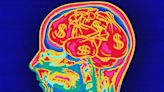 Inside the brain of the billionaire visionary: narcissism, risk, and disordered personality traits