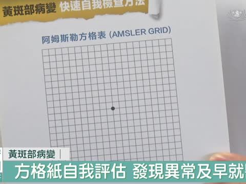 黃斑部病變難治療 方格檢測提早發現