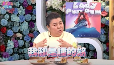 凝血功能崩壞腳腫脹！57歲林美秀驚罹血友病 「最新病況」曝光了