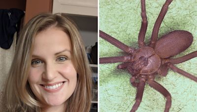 Brown recluse spider bite victims speak out: 'Pain like I've never felt'