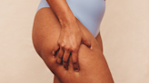 How to *Actually* Get Rid of Cellulite, According to Experts