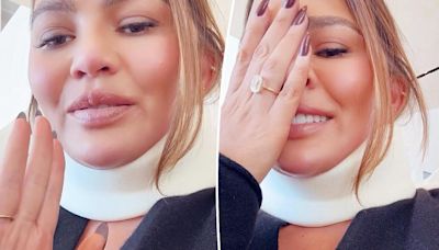 Chrissy Teigen explains why she skipped 2024 Met Gala after neck brace sparks concern