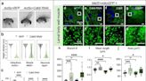 Fruit fly study identifies gene that may reverse Parkinson's disease