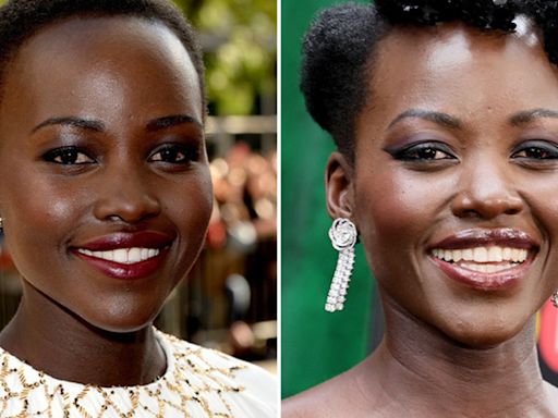 Lupita Nyong'o -- Good Genes or Good Docs?!