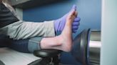 Shockwave therapy for heel pain