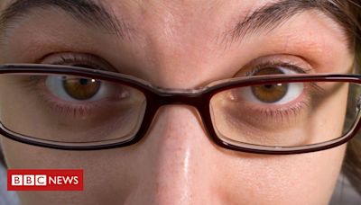 Ioga ocular: exercitar os olhos pode impedir ou atrasar o uso de óculos?