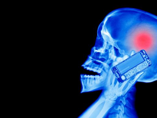 Scientists Determine Once and for all If Cell Phones Cause Brain Cancer