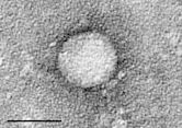Positive-strand RNA virus