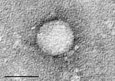 Hepatitis C virus