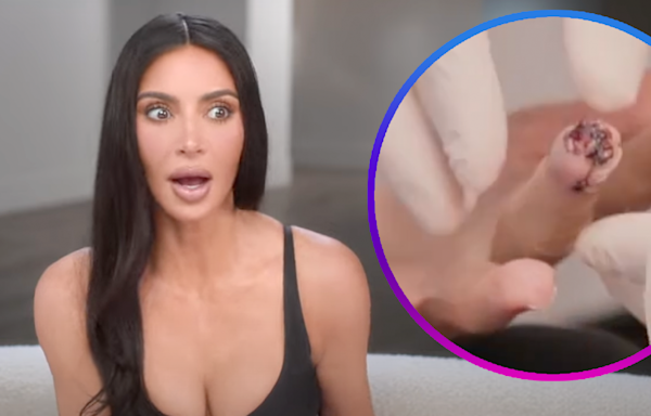 Kim Kardashian Slices Part of Her Finger Off, Says It Was 'More Painful Than Childbirth'