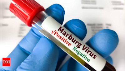 Marburg Virus: US CDC to release second-highest warning level for Marburg virus | - Times of India