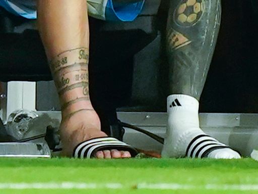 Copa América: así quedó el tobillo de Messi tras salir lesionado en la final contra Colombia