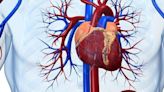 You May Not Have to Fast Before Catheter-Based Heart Test, Study Suggests