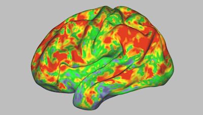 This is your brain on psilocybin