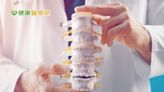 3D影像、機械手臂用於脊椎手術好處多 但醫師指出仍有「這些」缺點！