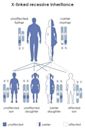 Becker muscular dystrophy