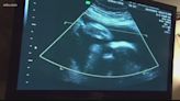 What defines a heartbeat? Judge hears arguments in South Carolina abortion case