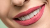 7 trucos para tener dientes blancos y eliminar las manchas