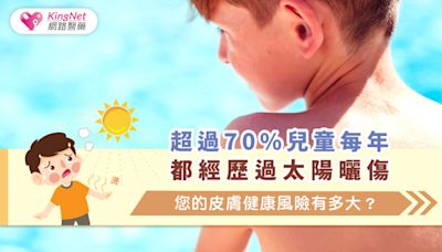 超過70%兒童每年都經歷過太陽曬傷，您的皮膚健康風險有多大？