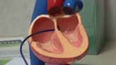 HealthWatch: Fixing a hole in your heart