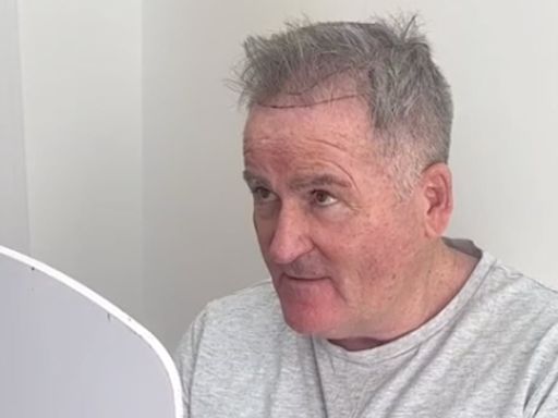 Richard Keys undergoes hair transplant treatment