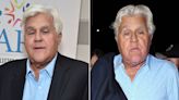 Jay Leno Teases That His 'Brand New Face' Is 'Better Than What Was There Before' Accident