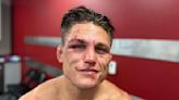 Drew Dober reassures fans and insists there is 'no shame in failure'