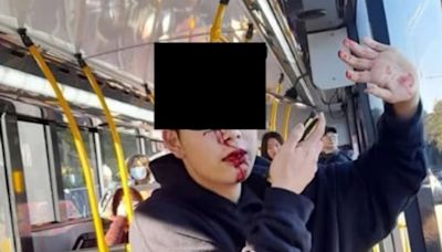 華留學生坐巴士遭辱罵 鐵棍打甩多隻牙