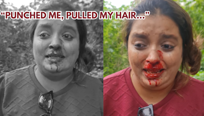 'Punched me Twice, Pulled my Hair': Pune Woman with Bleeding Face Tells Why Elderly Assaulted Her; VIDEO