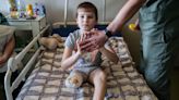 "Held severed leg pressed to body to prevent it from bleeding out": story of 11-year-old boy from Kharkiv Oblast – photos