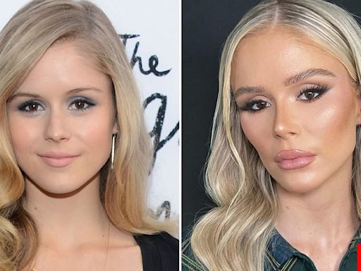 Plastic surgeon reveals procedures Erin Moriarty has had