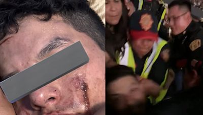 ¡Caos en concierto de Madonna! Fanático denuncia que policías lo sacaron y golpearon