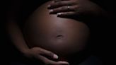 US maternal mortality rate declines, but disparities remain, new CDC data shows