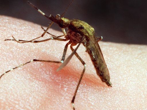 Mosquito bites are a pain. A doctor weighs in on how to ease the discomfort.