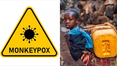 Exponential Spike In Monkeypox Outbreak Affecting Children In DR Congo; Know How