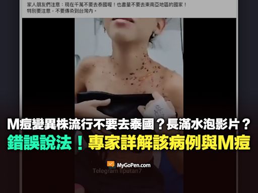 【錯誤】M痘變異株流行不要去泰國？長滿水泡影片？不實說法！專家詳解