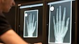 Radiologist shortage hits West Michigan, delays results
