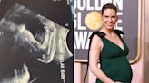 Pregnant Hilary Swank Shares Epic Ultrasound Photo of One of Her Twins 'Flexing': 'Prize Fighter'