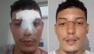 Entregador tem rosto cortado por linha com cerol no Ceará: 'eu podia ter morrido'