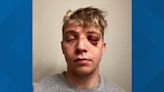 'An innocent victim' | Attorney representing student allegedly beaten by U of I football players speaks out