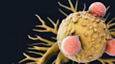 Discovery of Tumor Cells' Ability To Evade the Immune System Could Improve Cancer Immunotherapies